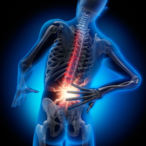 Determine How Much a Herniated Disc Settlement May Be Worth