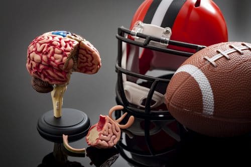 Second-Impact Syndrome is a Serious Concern for Athletes Who Have Suffered Football Head Injuries
