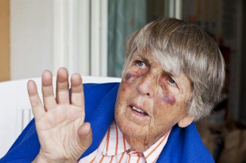 Study Finds That Instances of Elder Abuse Are on the Rise