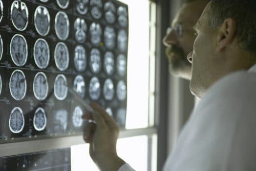 Understanding Traumatic Brain Injury Symptoms