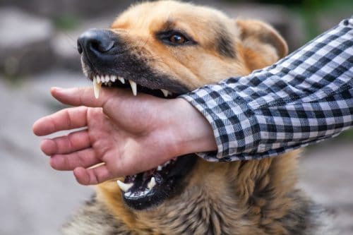 How to Get Compensation for a Dog Bite Injury