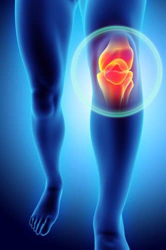 DePuy Attune Knee Replacement Defects Can Cause Serious Pain